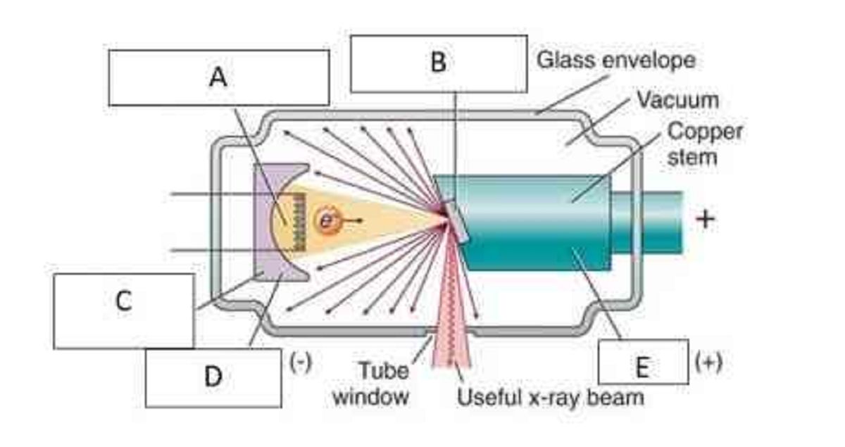 Identify the major technique error on your patient’s bitewing. Take