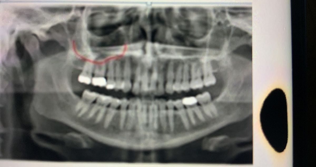 Year4/Oral Surgery/Dr.Pin Bosara Take the Quiz QuizMaker