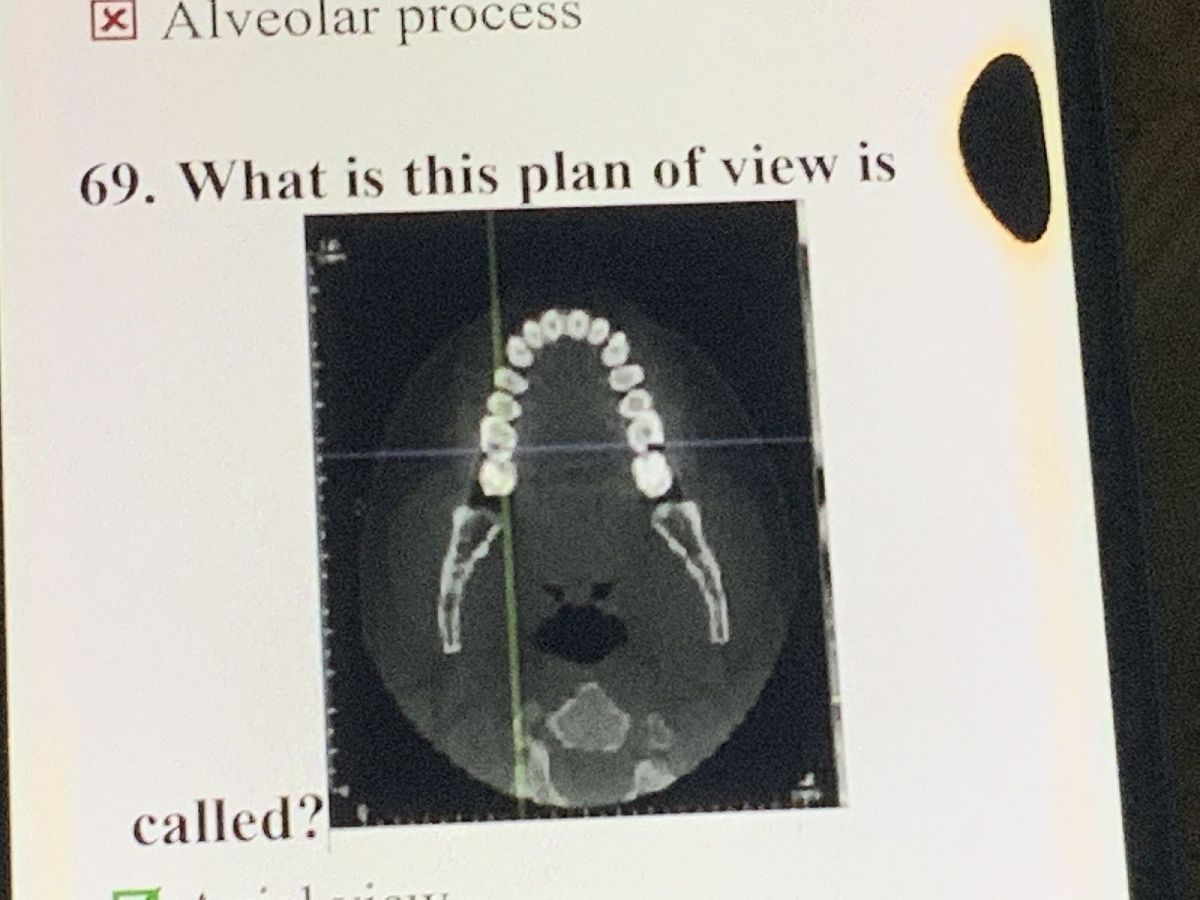 Year4/Oral Surgery/Dr.Pin Bosara Take the Quiz QuizMaker